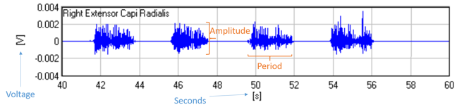 Delsys.com / https://delsyseurope.com/downloads/TECHNICALNOTE/101-emg-sensor-placement.pdf The EMG signal in grahpical form.