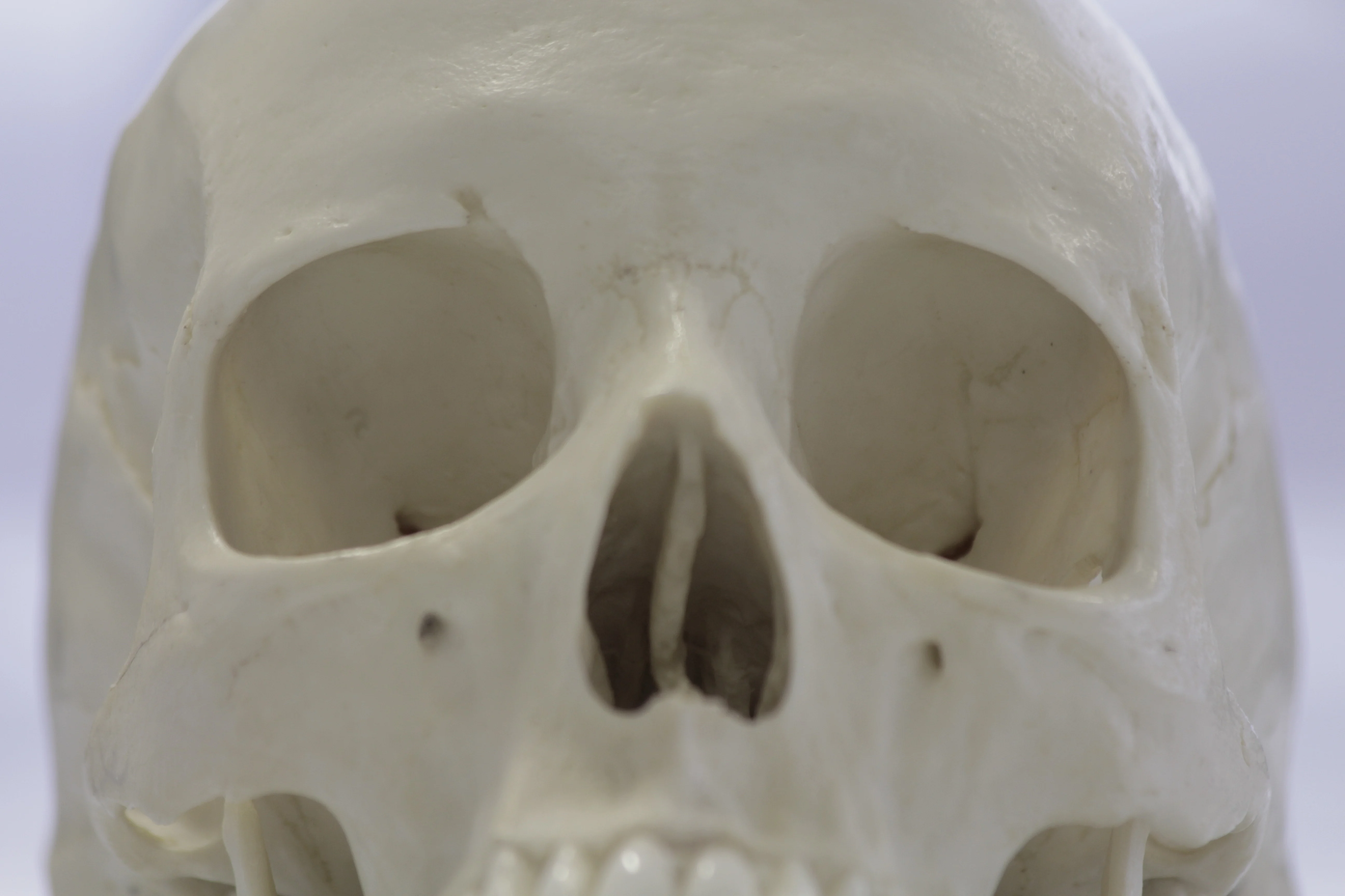 Identifying The Sex Of A Skull