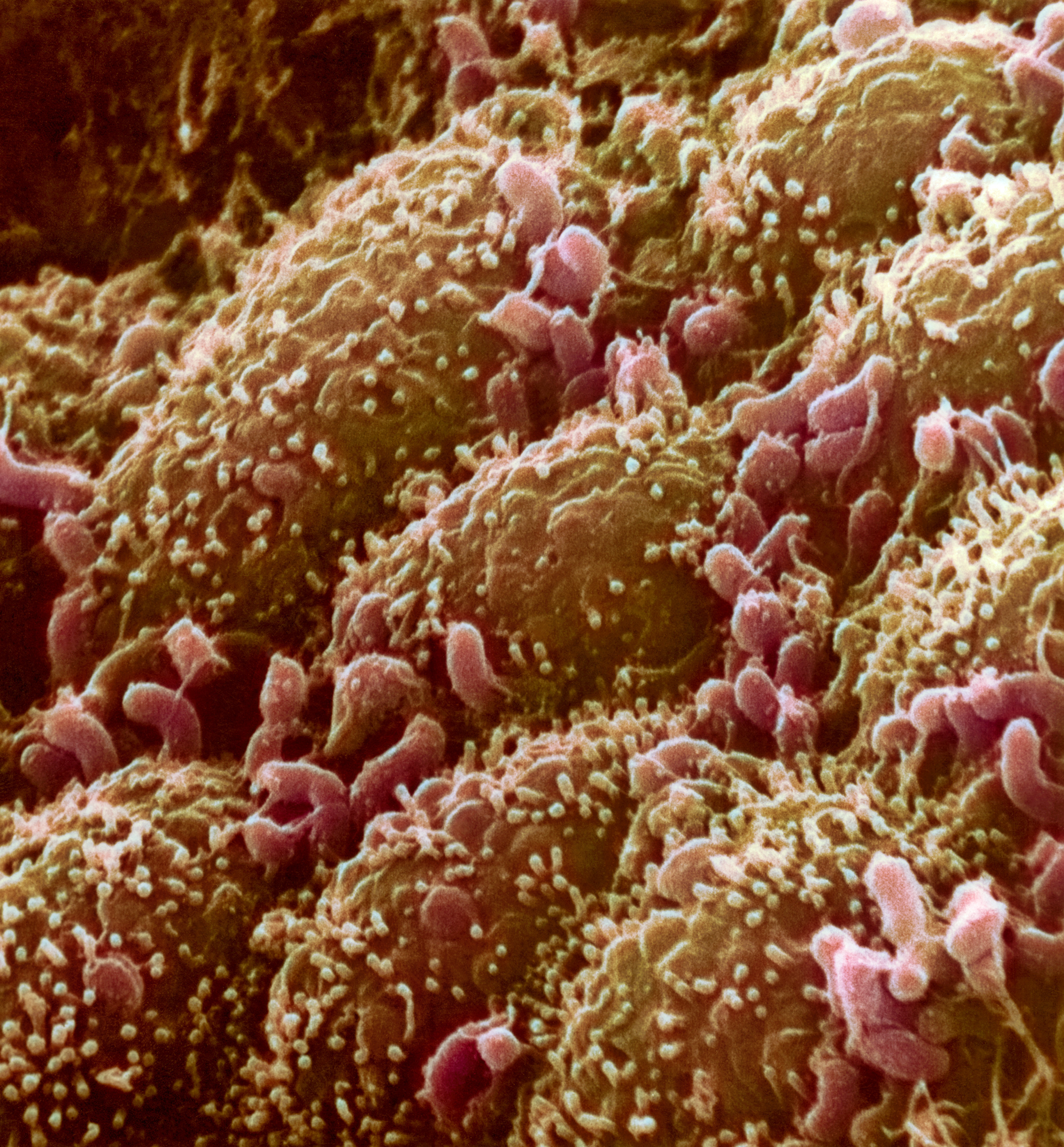 Colourised electron microscopy image of human gut bacteria Bifidobacterium bifidum