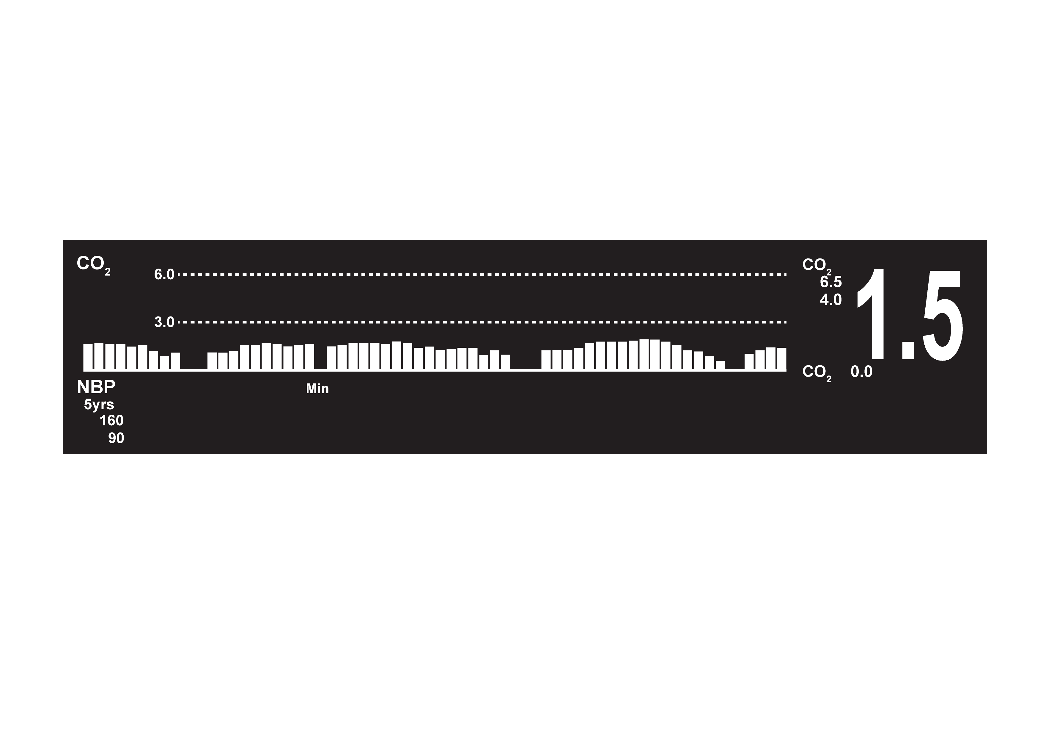 attenuated capnography trace