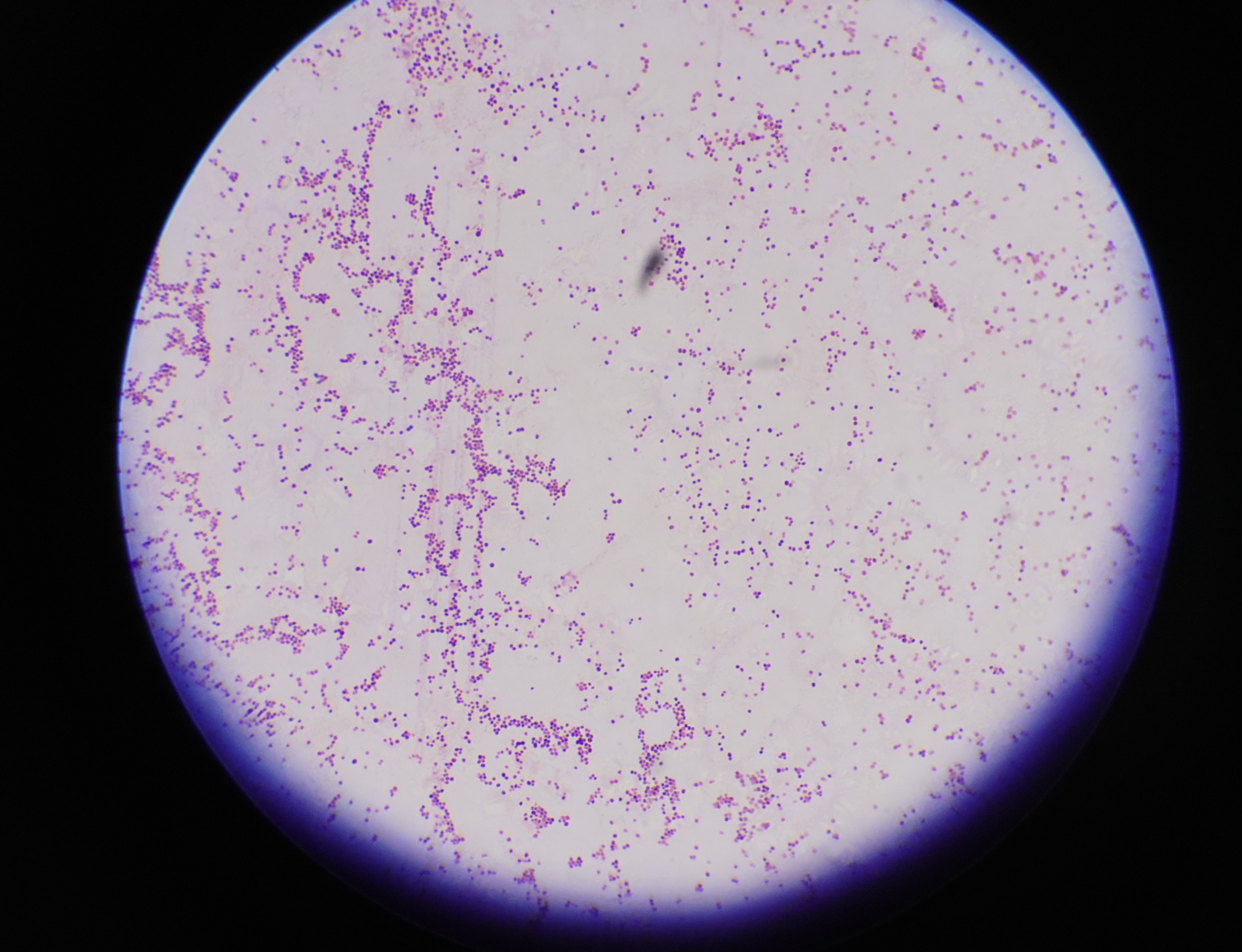 gram-positive bacteria