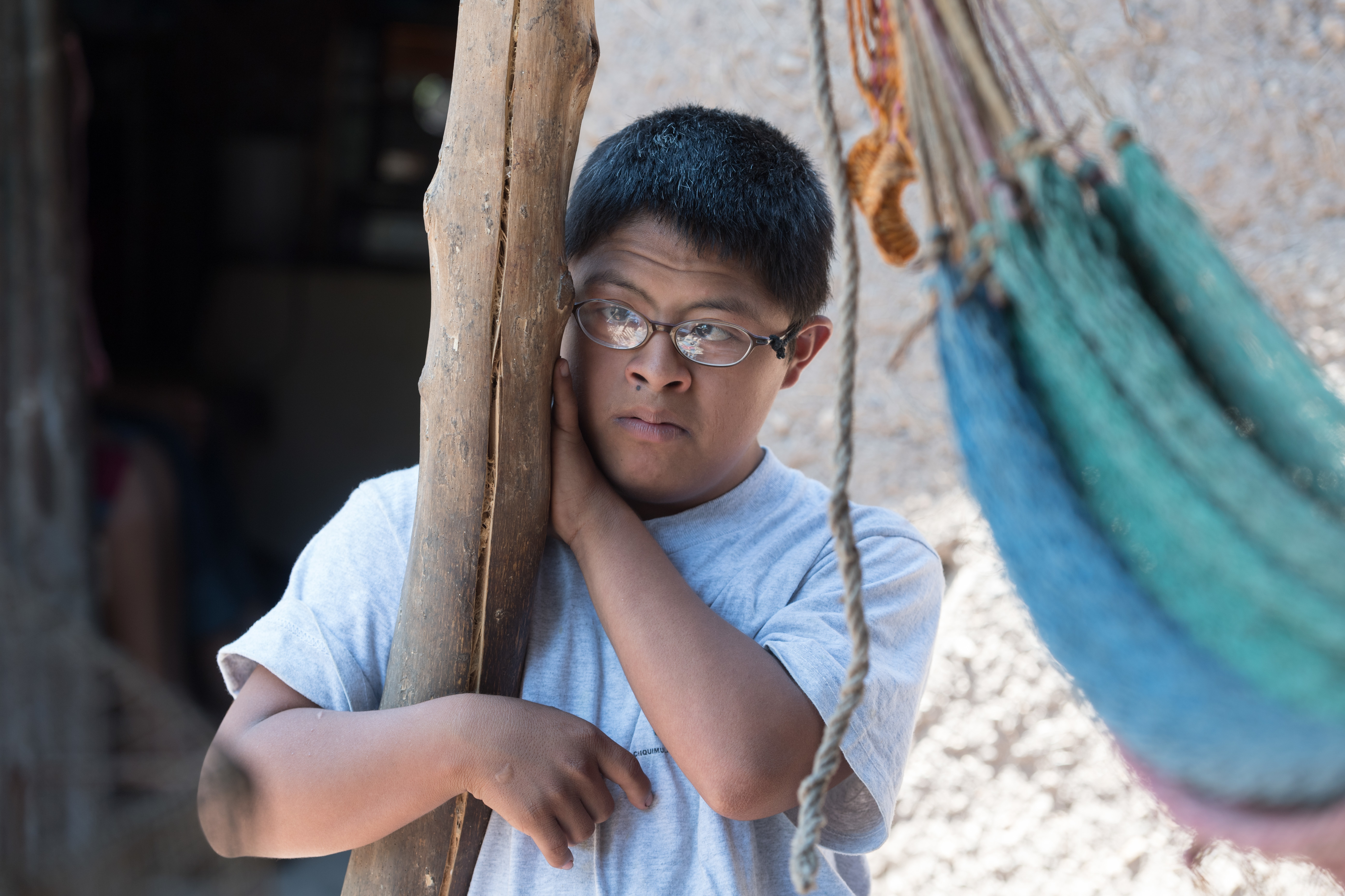 A teenager with Down syndrome is leaning against a wooden post.