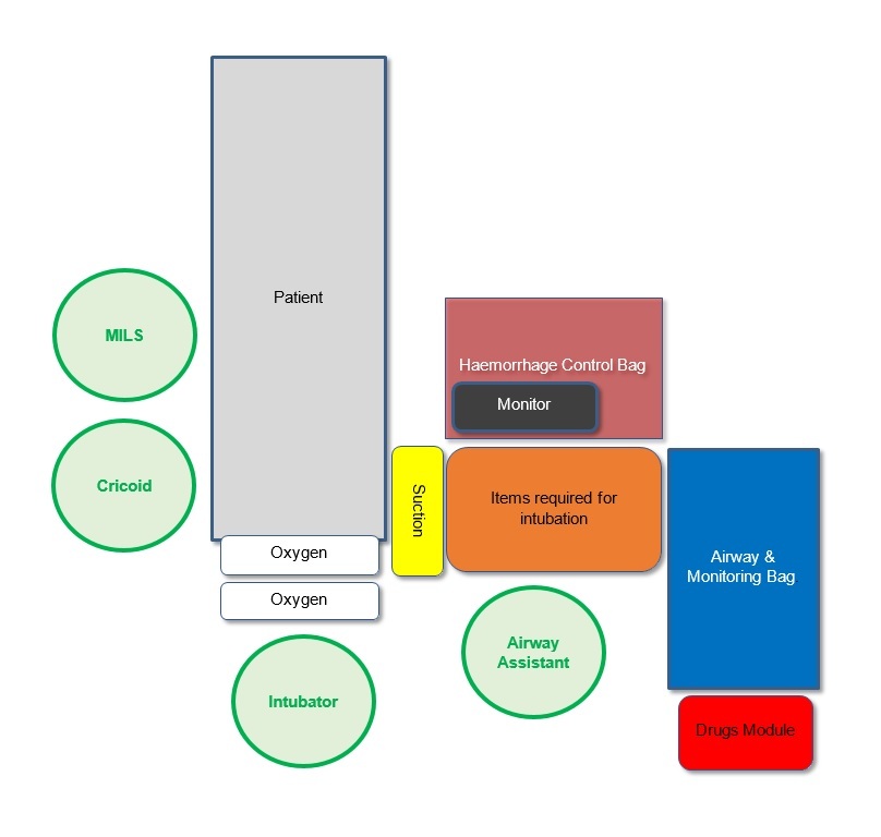 Schematic representation of the RSI kit dump setup - locaitons of kit and personnel