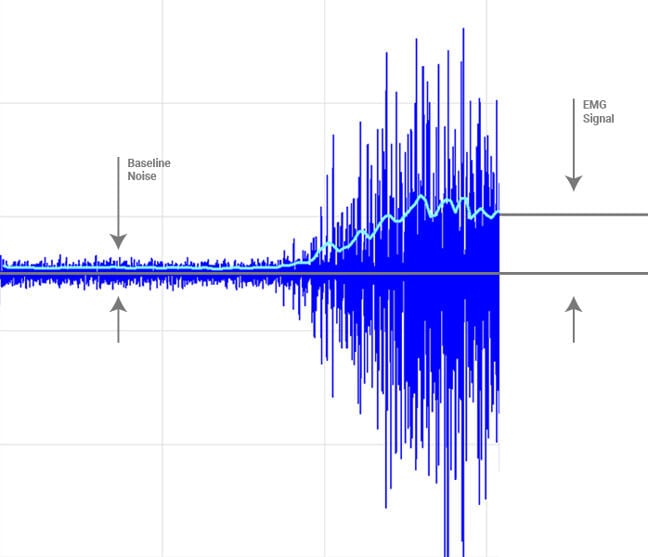 Delsys.com / https://delsyseurope.com/emgworks/signal-quality-monitor/factors/#sources A graph showing baseline noise and EMG signal.