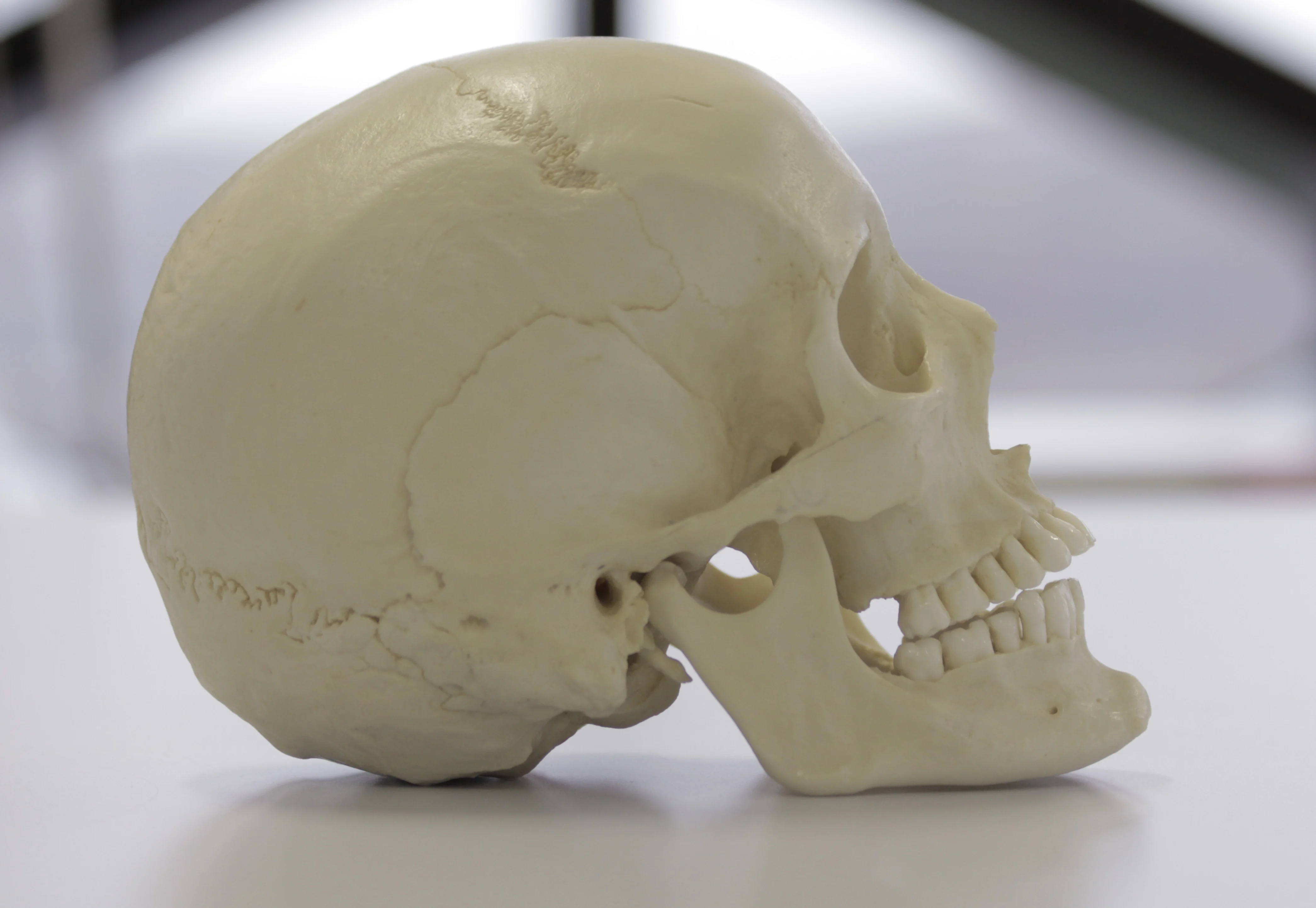 Identifying The Sex Of A Skull