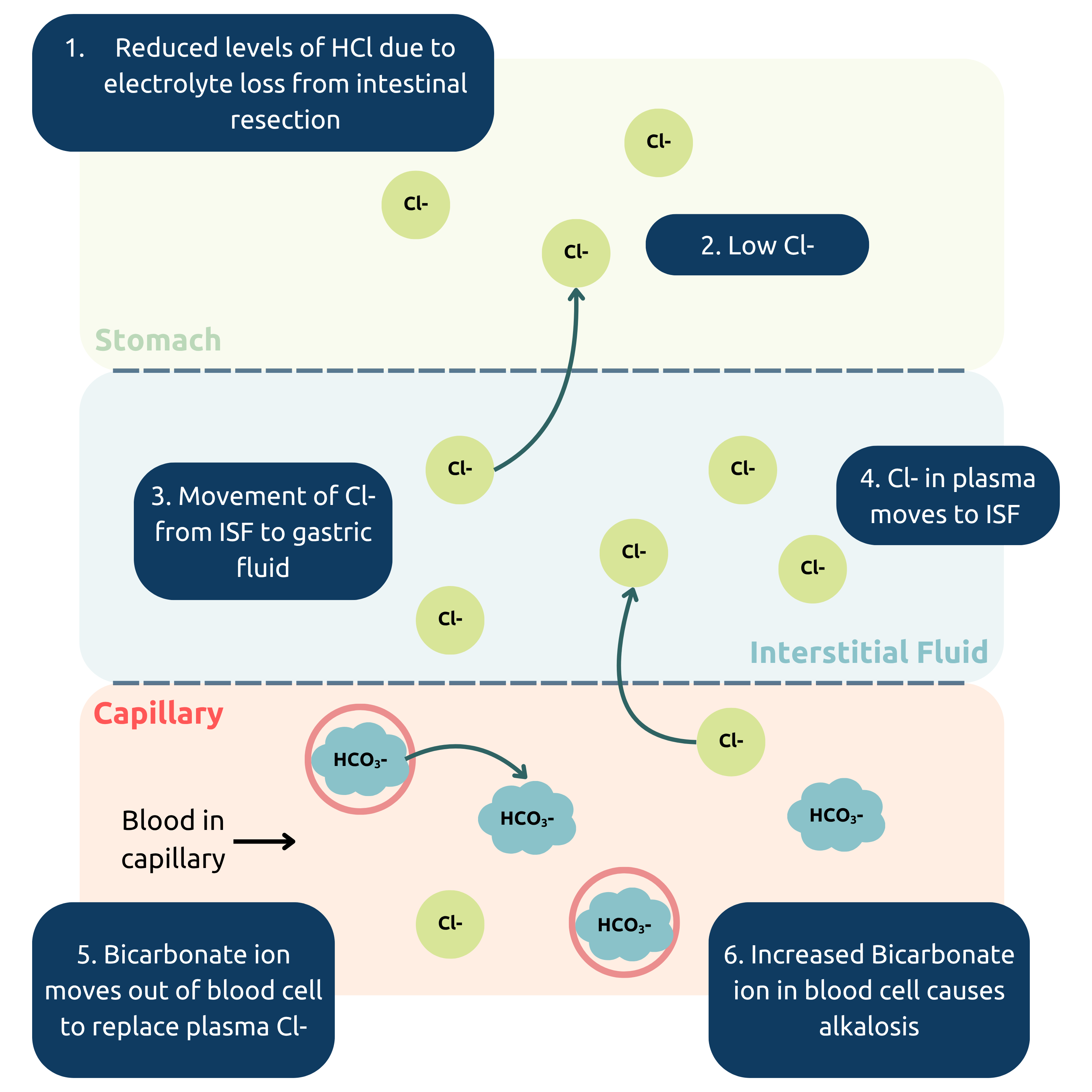 Infographic describing how electrolyte imbalance can lead to hypochloraemic alkalosis.