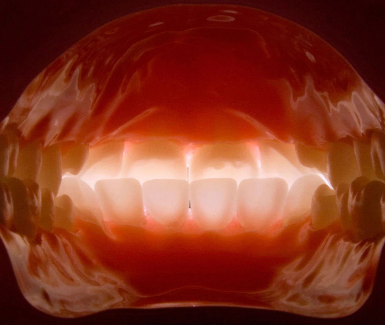 An intra-oral digital dental photograph