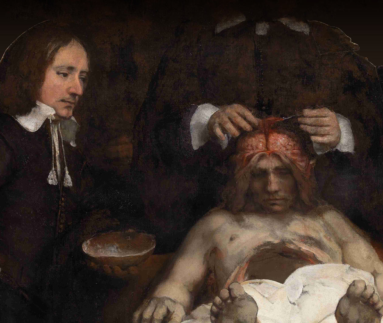 Rembrandt's Anatomic lesson by Dr Deijman