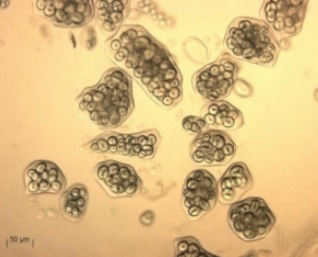 Raw kidney bean cells packed with starch