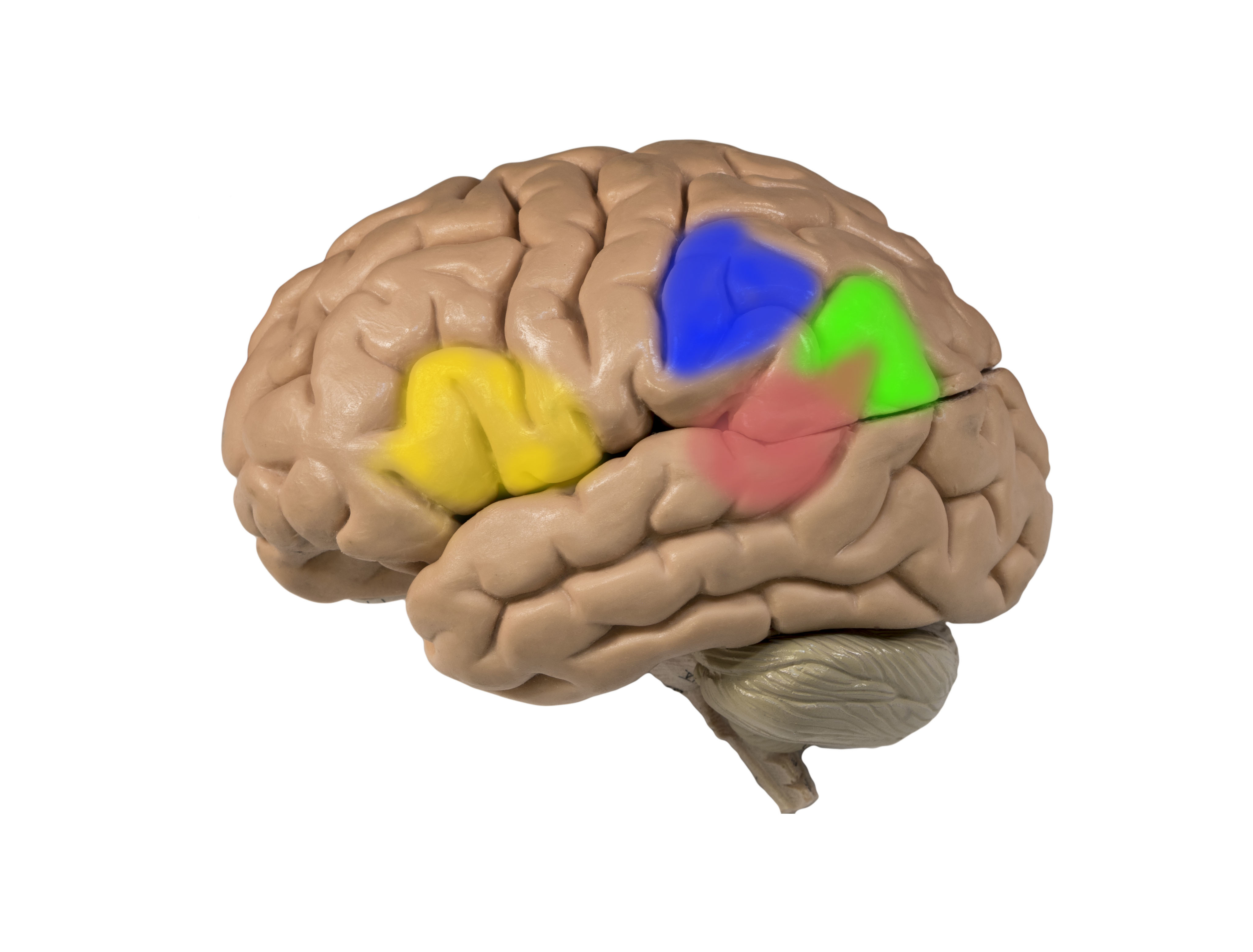 The left hemisphere marked