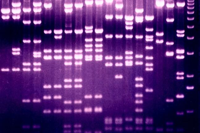 A DNA gel with different length fragments