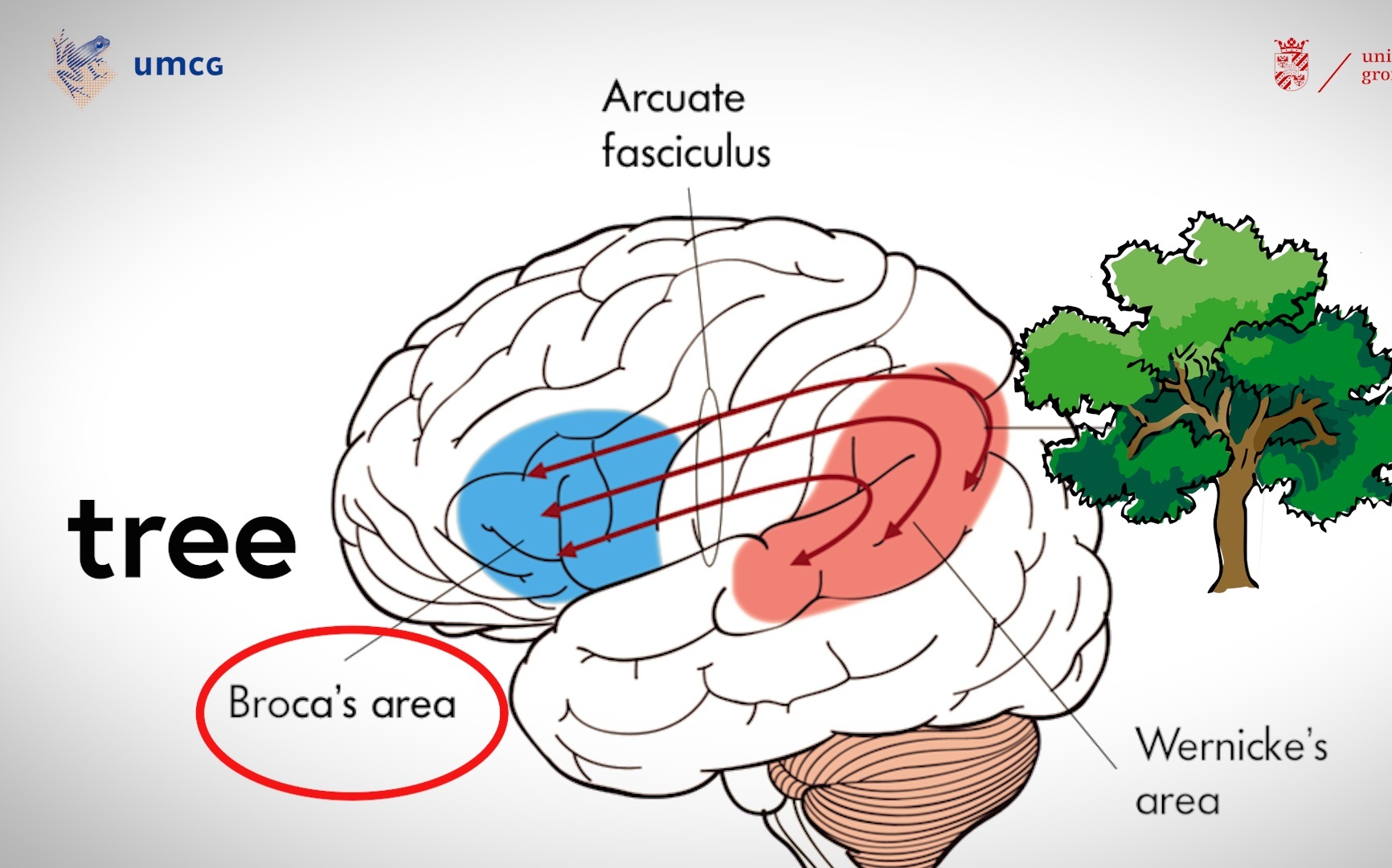 The communication between the classical brain areas for language