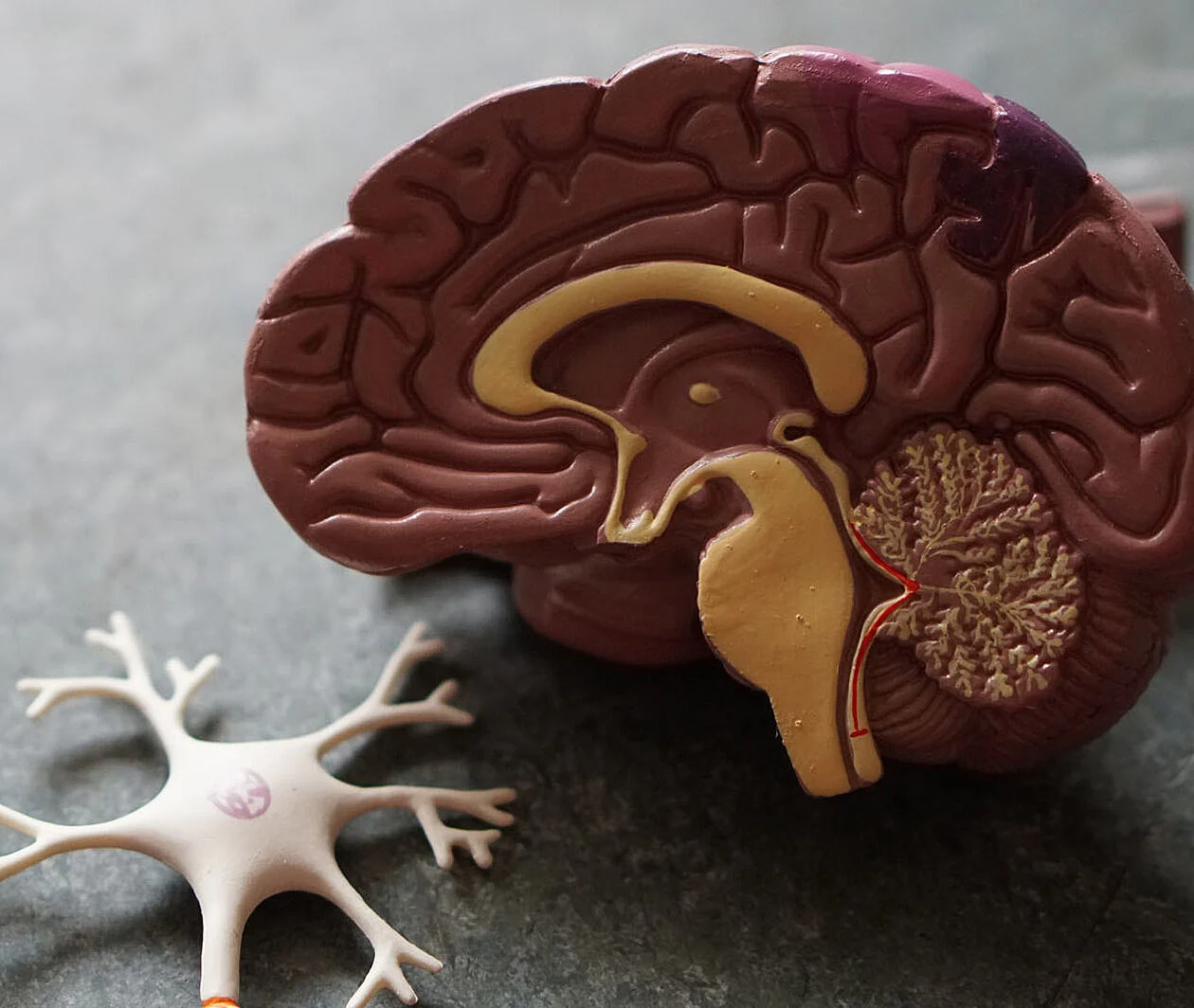 model of a brain split in half