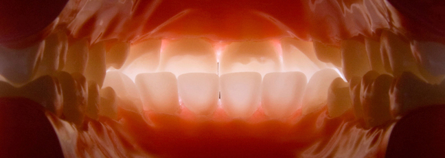 inside view of a mouth from the throat
