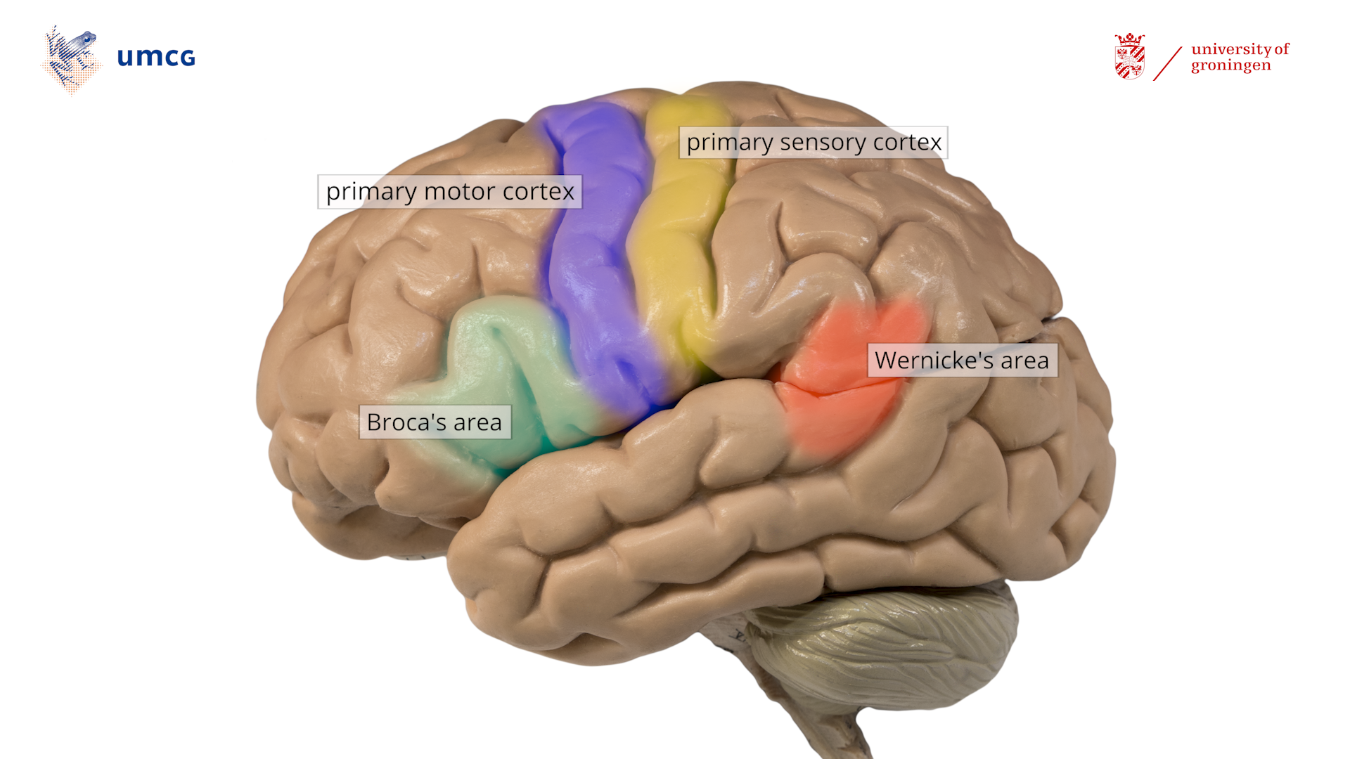 The left hemisphere with crucial regions