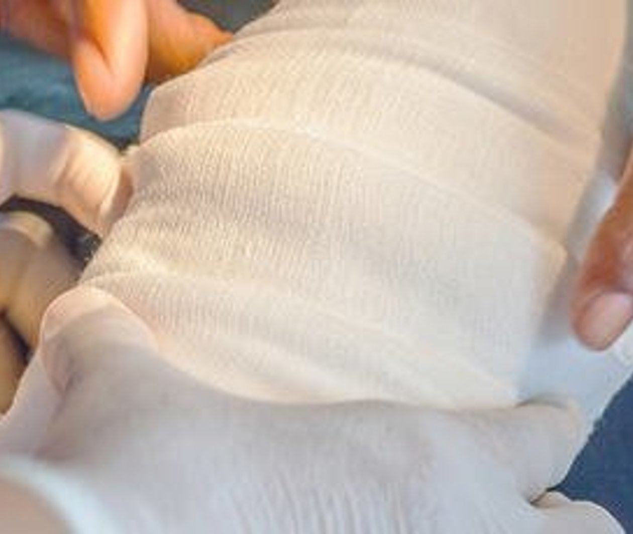 Antimicrobial Stewardship in Wound Management