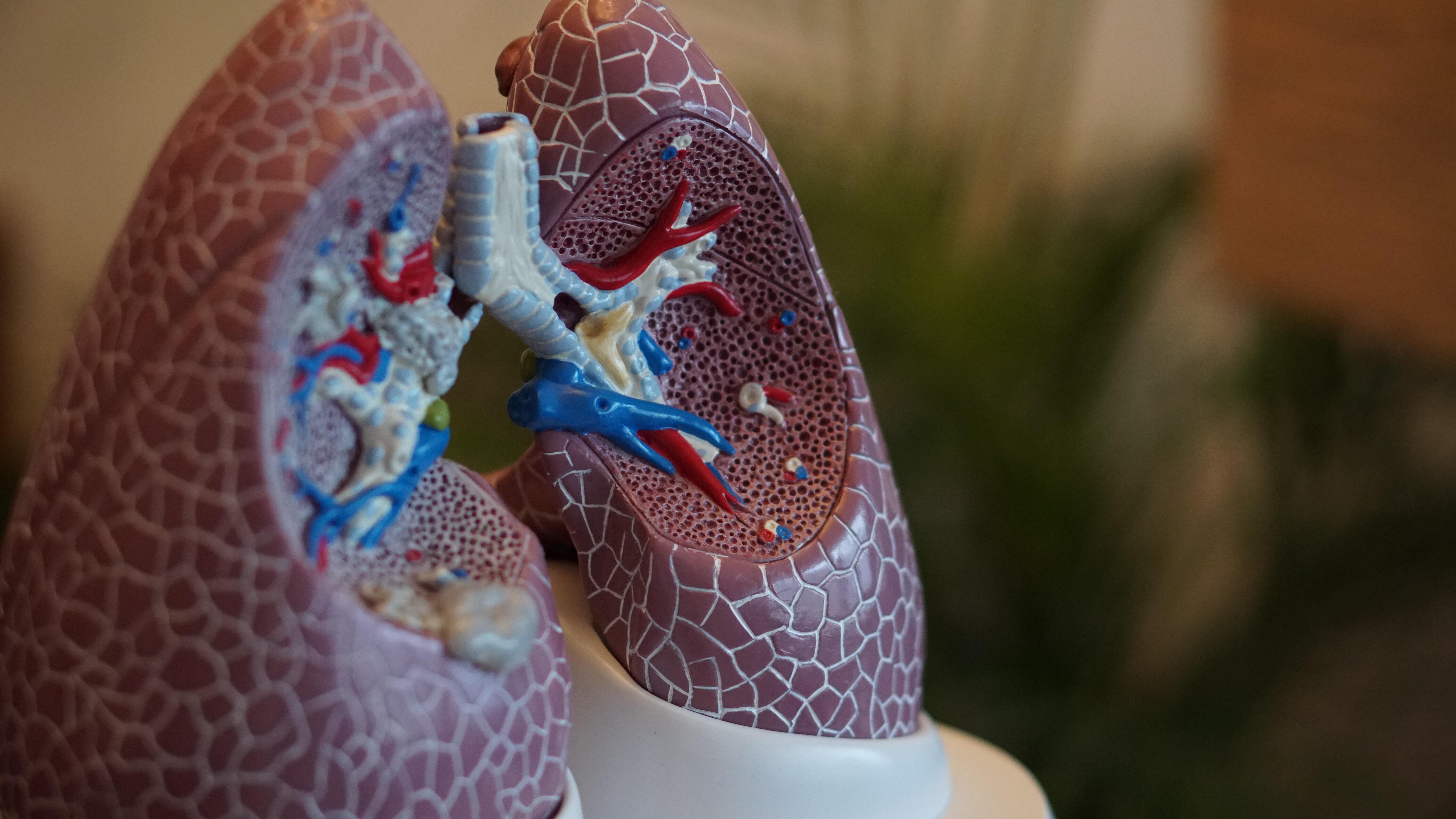 Plastic model of the lungs