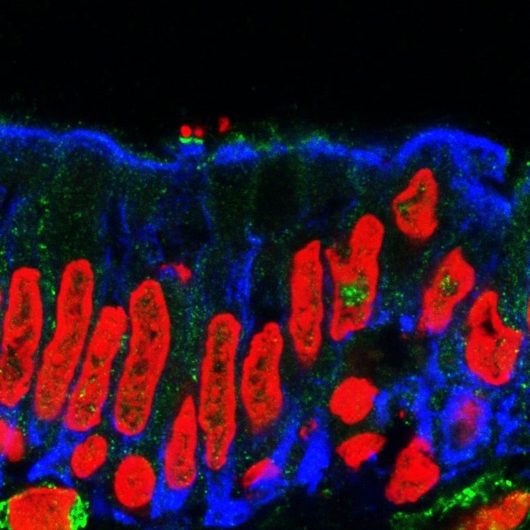 Enteropathogenic _E. coli_ (EPEC) binding to human intestinal epithelium. The bacteria (green) attaching to the intestinal cells' membranes (blue).