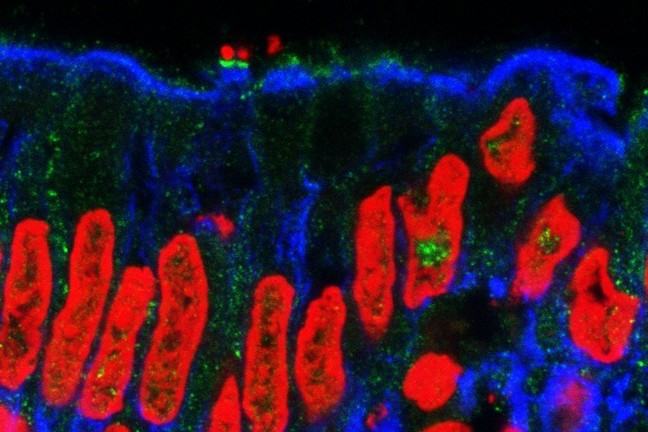 Enteropathogenic E. coli (EPEC) binding to human intestinal epithelium. The bacteria (green) attaching to the intestinal cells' membranes (blue).
