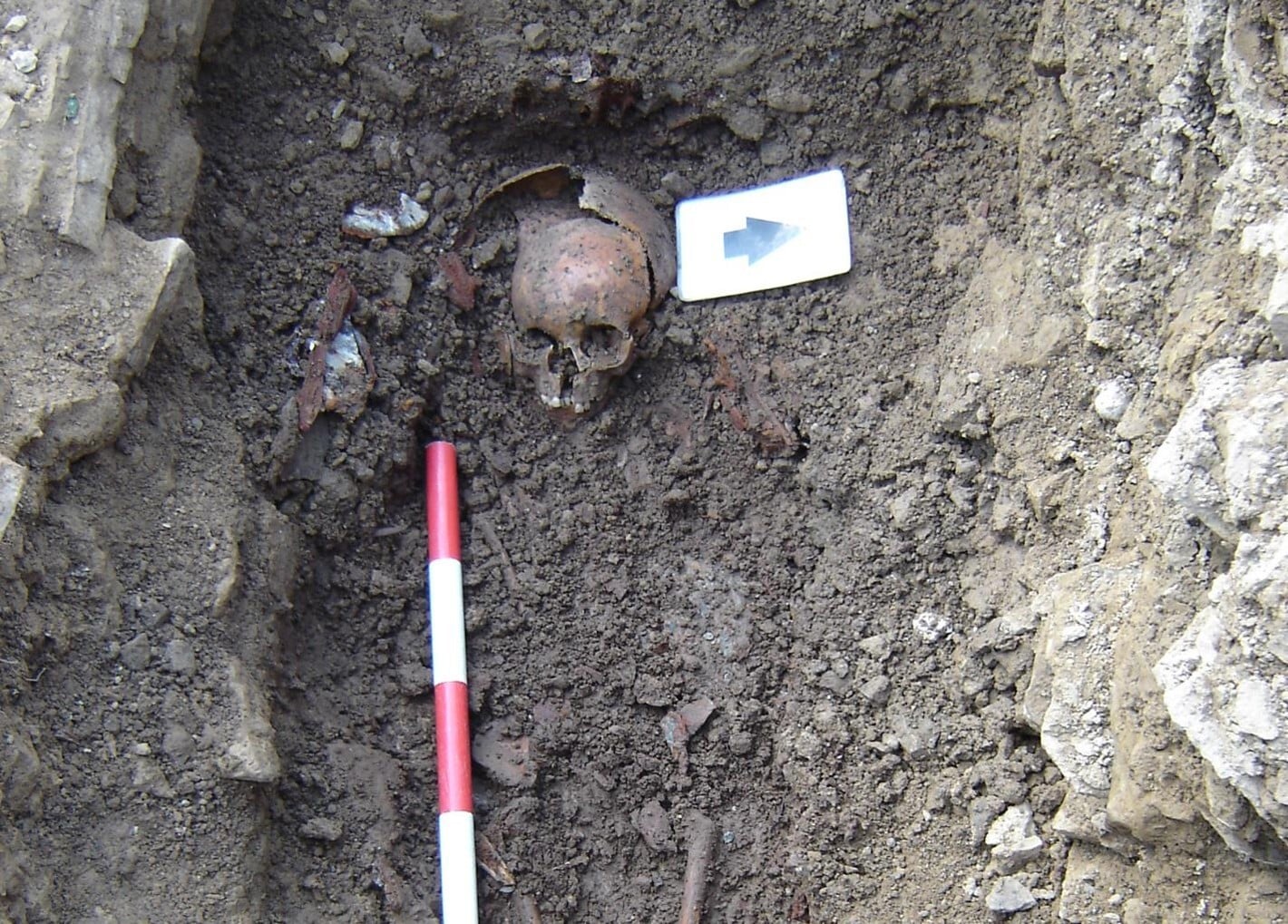 A partially disarticulated skeleton. A grave partially excavated with the skull of a skeleton visible in the ground