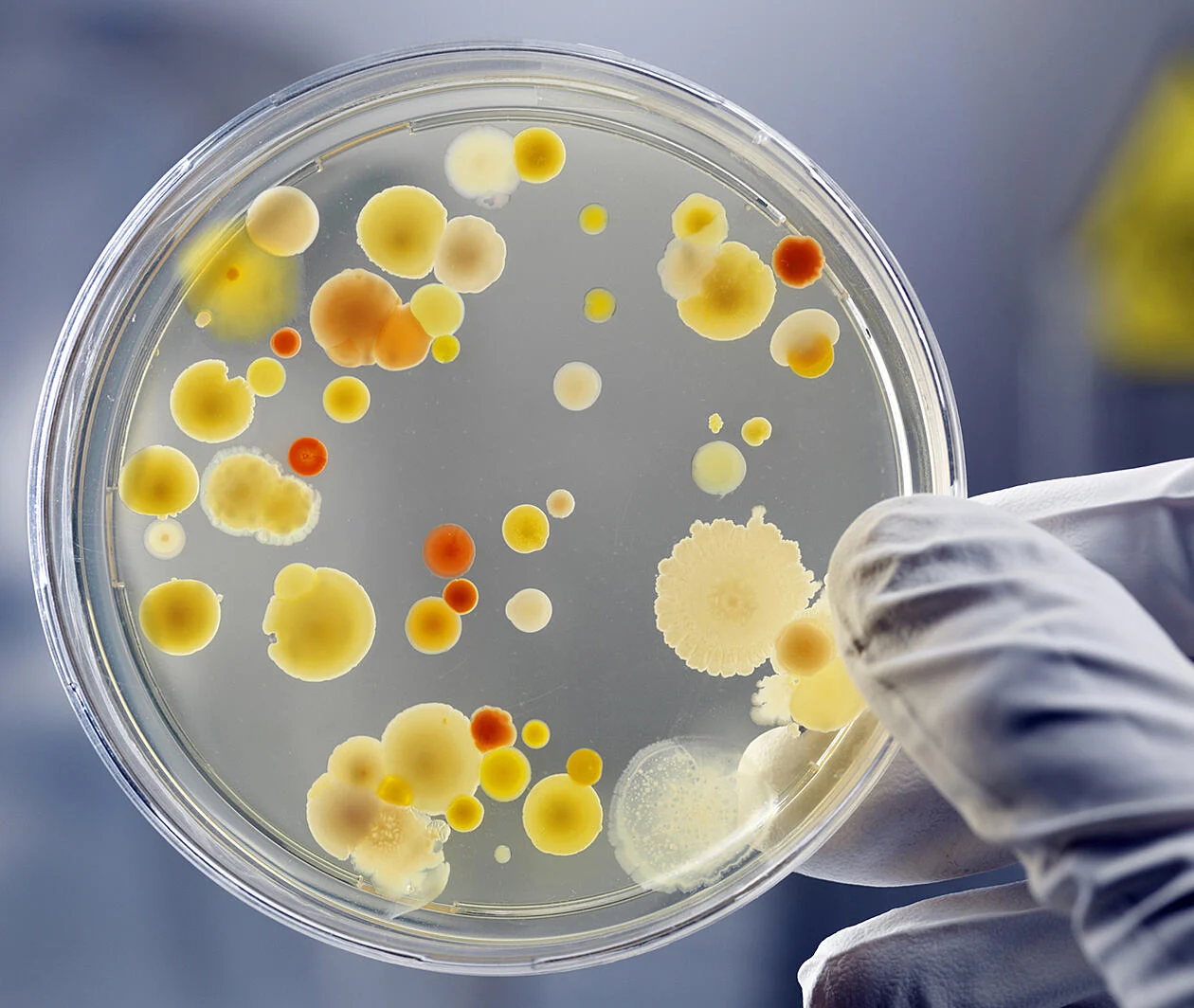 Petri dish with cultures