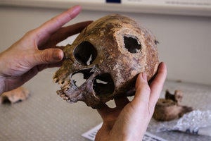Archaeology: a human skull is examined in the lab.