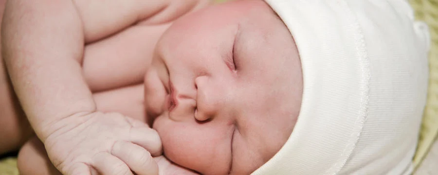 How newborn skin differs