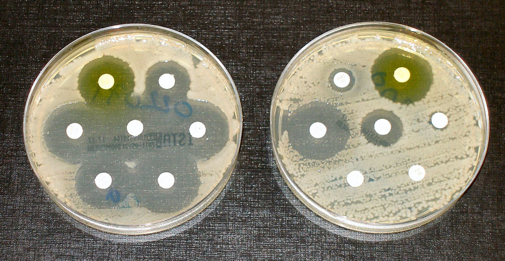 Two petrie dishes with bacterial samples depicting bacterial multiplication