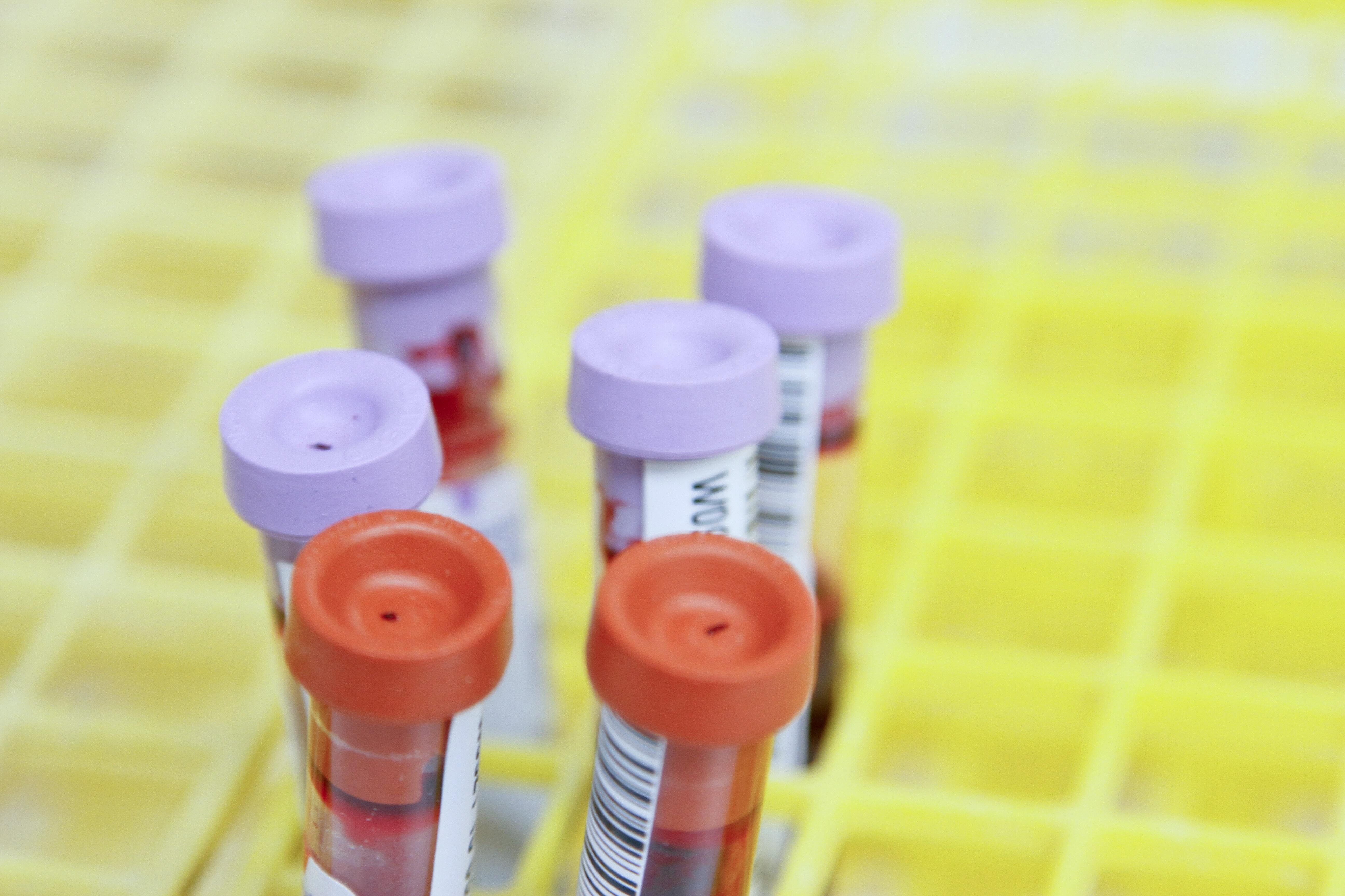 Blood samples in yellow tray