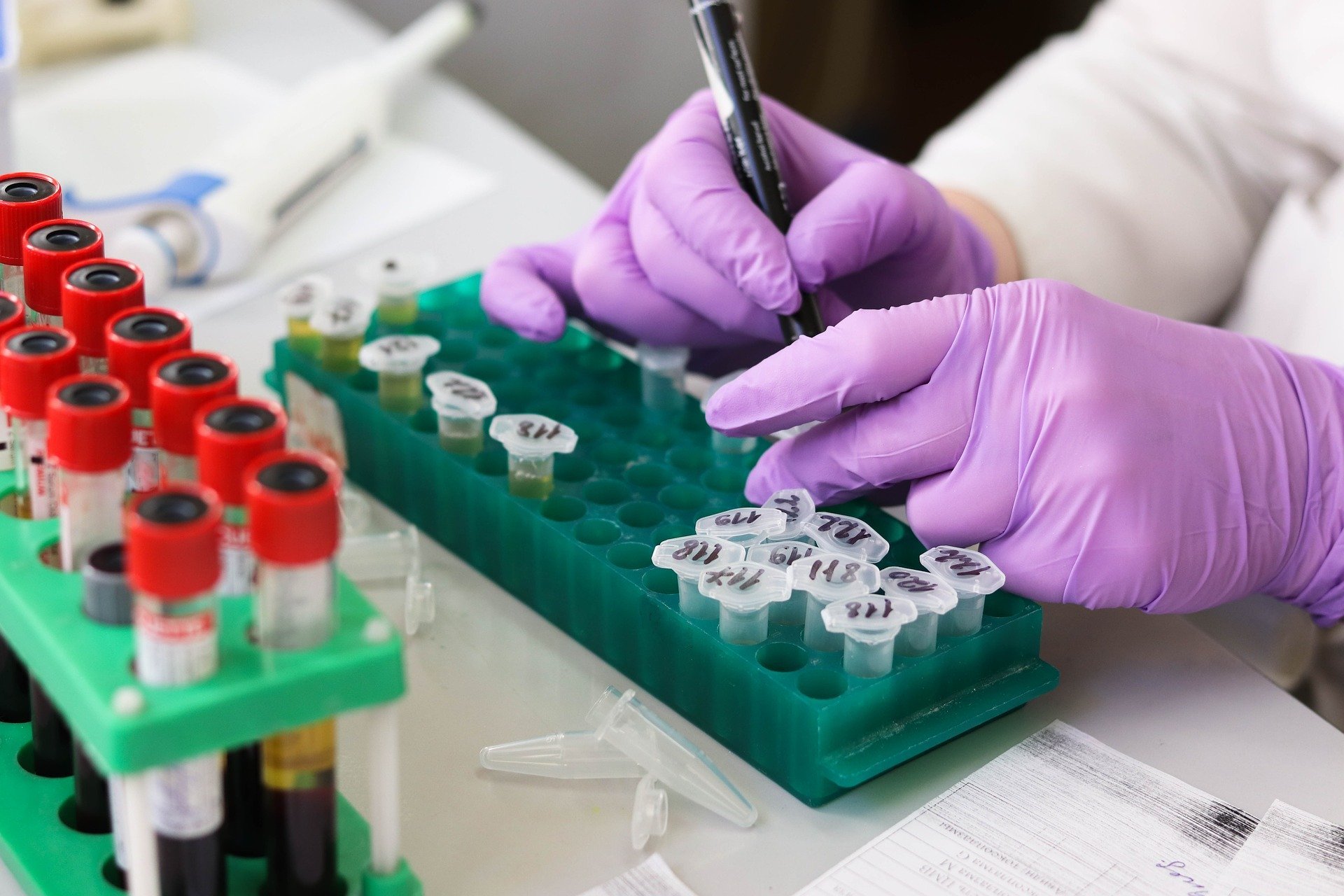 close up of person writing on eppendorf tubes