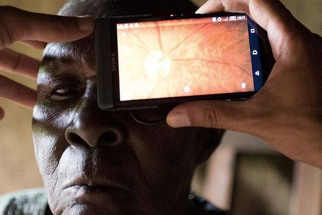 Examen des yeux en utilisant un smartphone