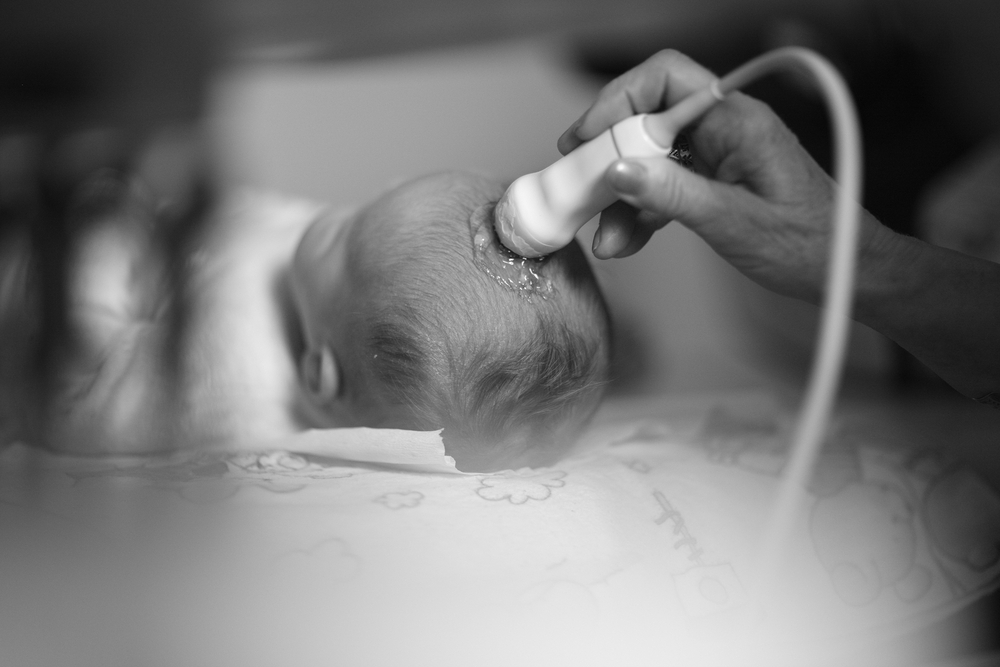 A newborn baby is have the top of their head examined with an ultrasound device.