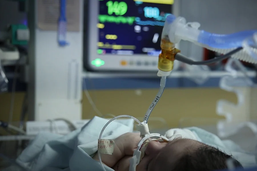 Close up of a preterm baby receiving monitored supplemental oxygen in the NICU