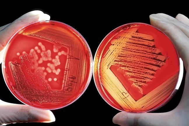 Bacteria growing on agar dishes