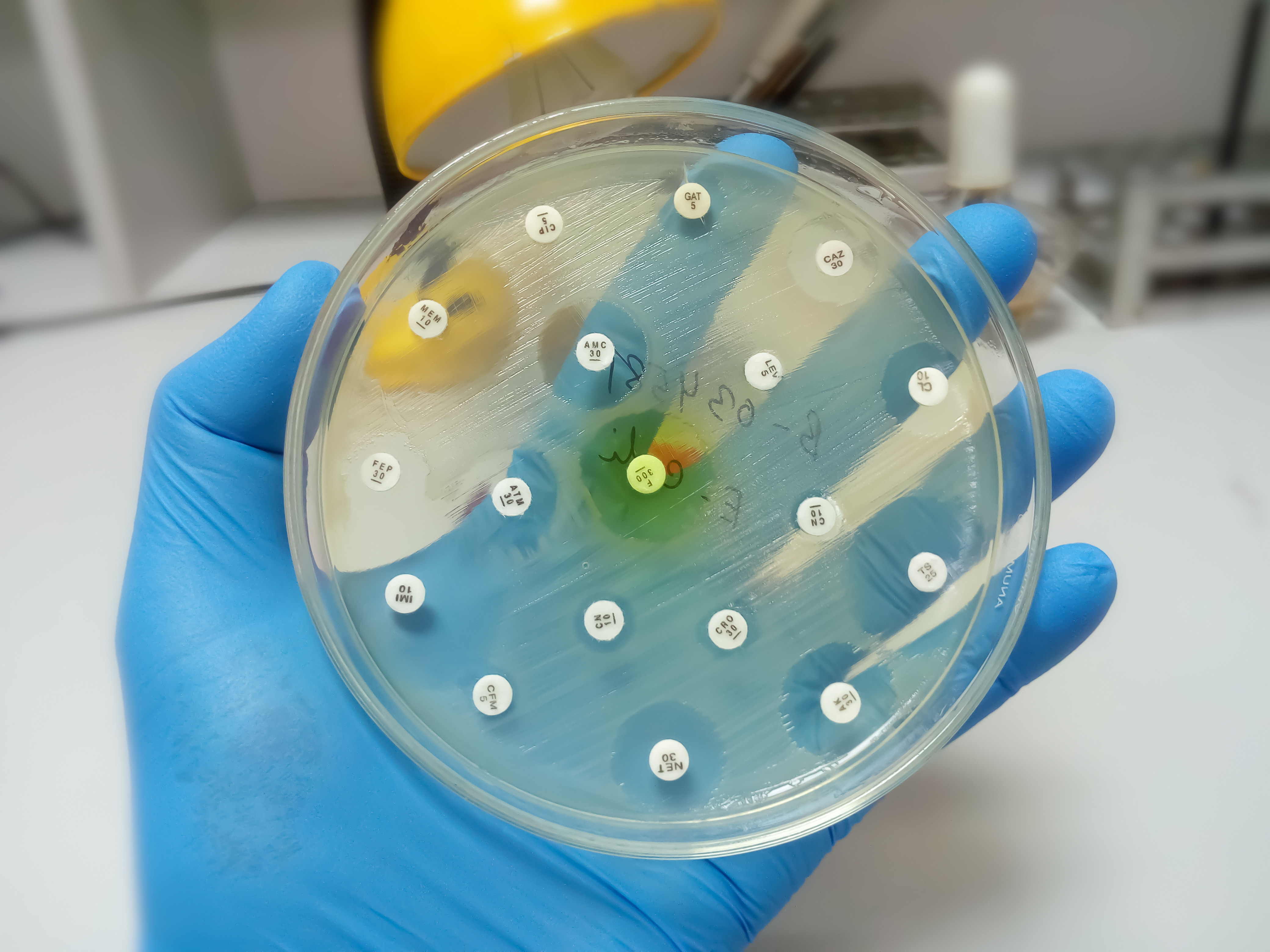A petri dish being held by a gloved hand with antimicrobial discs set up to perform susceptibility testing.