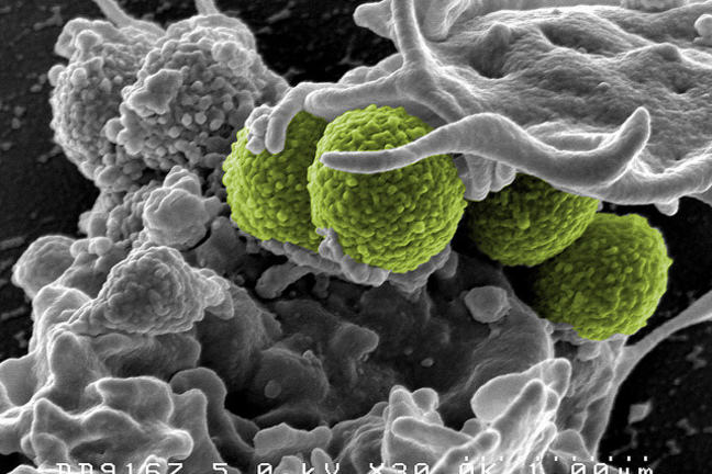 Picture of Hospital associated Methicillin-resistant Stappylococcus aureus under the microscope stained green.