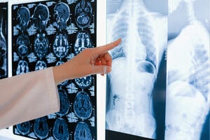 The doctor's finger pointed to the lung X-ray examination description