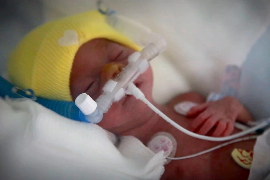 Small preterm baby in an incubator with many tubes attached and wearing a knitted yellow hat