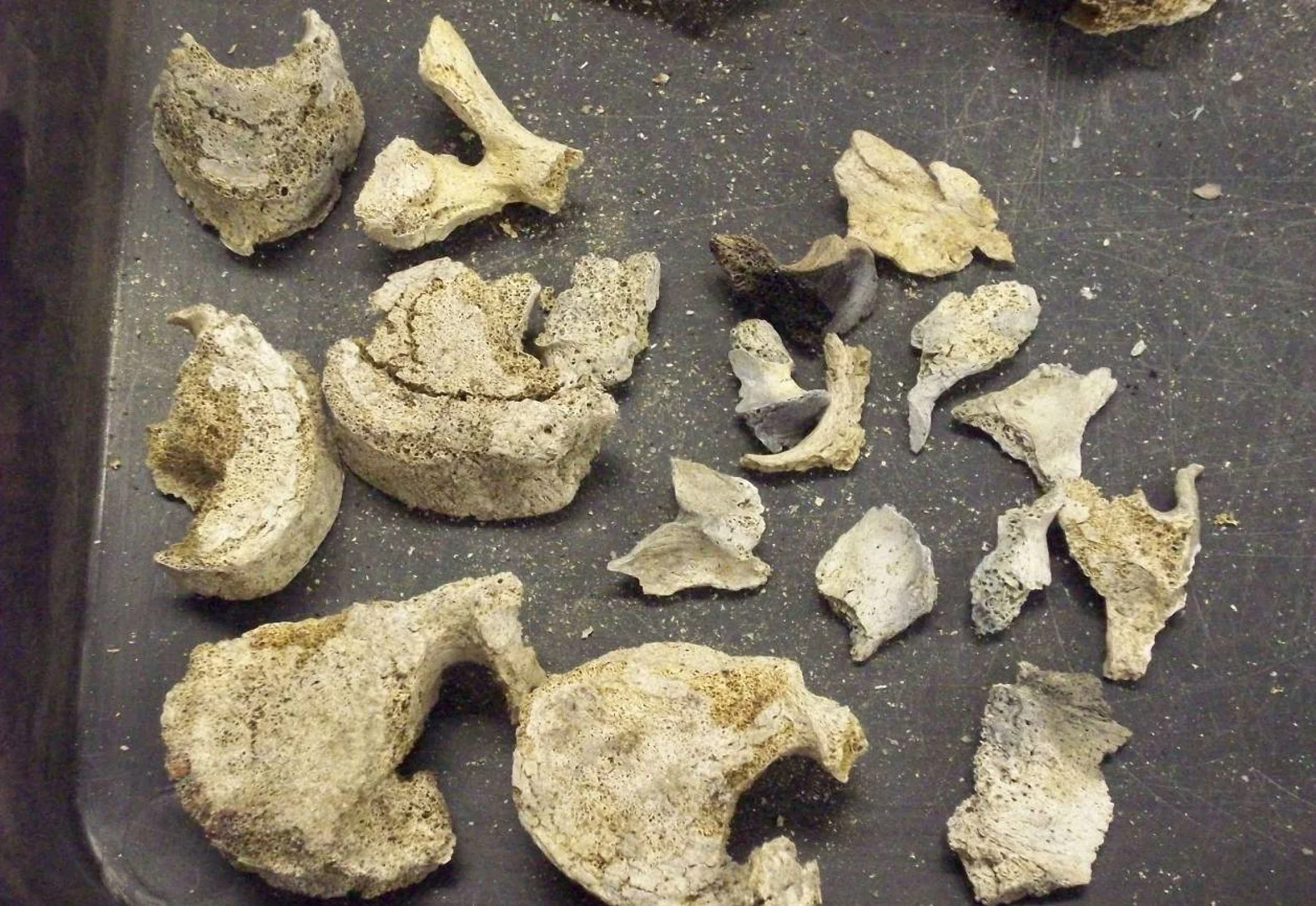 Fragments of the spine and other bones that are white and grey from burning.