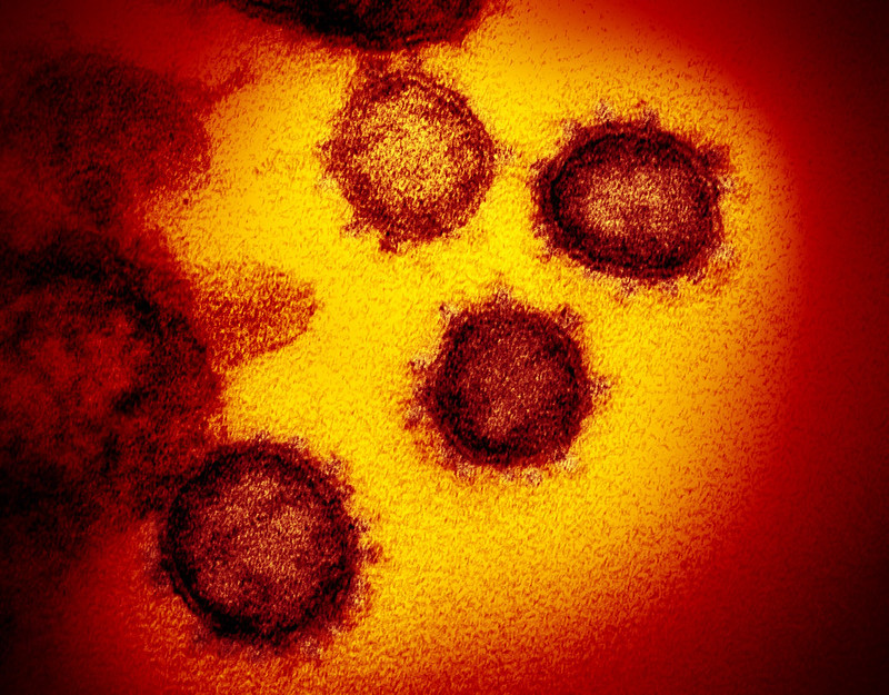 Novel Coronavirus SARS-CoV-2 This transmission electron microscope image shows SARS-CoV-2—also known as 2019-nCoV, the virus that causes COVID-19. isolated from a patient in the U.S., emerging from the surface of cells cultured in the lab.