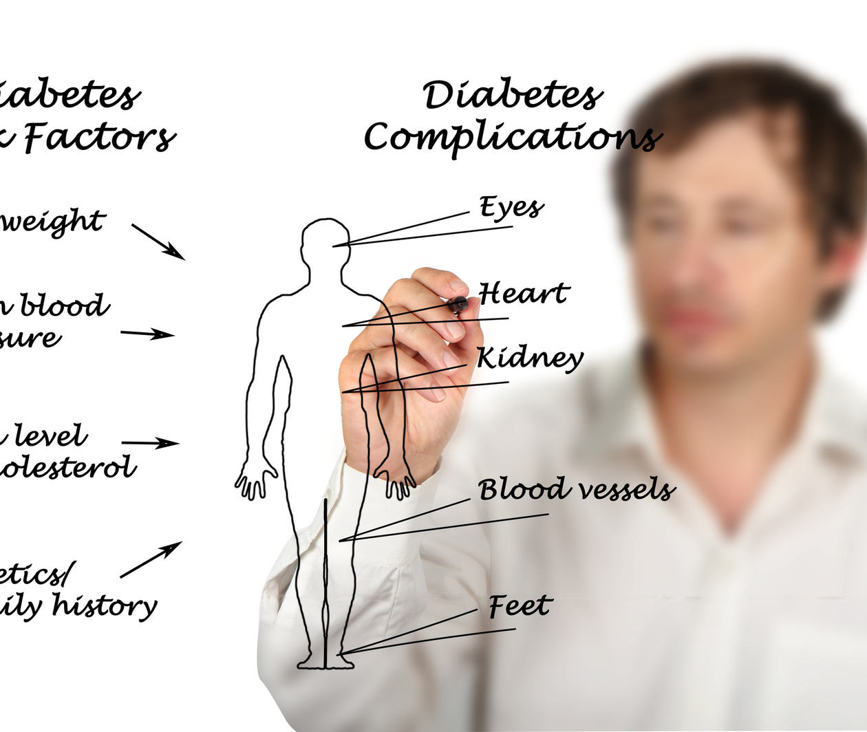 Man drawing a diagram of risk factors and complications of diabetes on window with a marker.