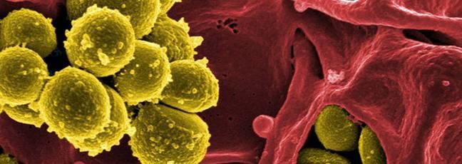 Cells seen under a microscope