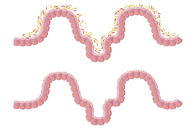 Gut Microbiota