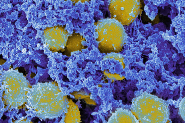 Staphylococcus aureus Bacteria