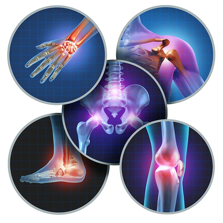 Common places where MSK pain is reported joints such as hands, shoulder, feet and knees.