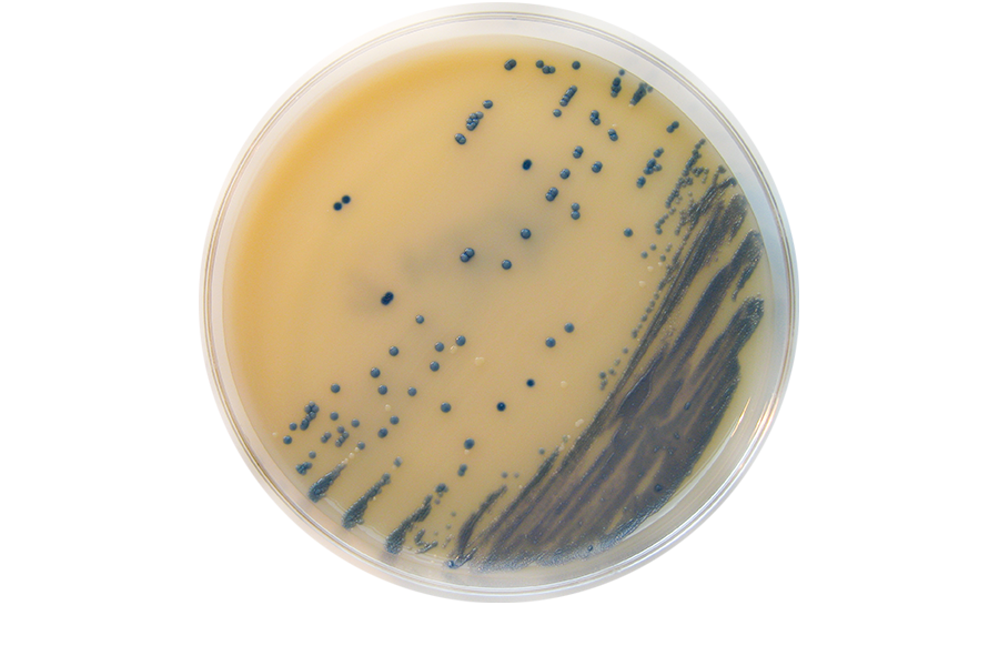 Methicillin-resistant Staphylococcus aureus (MRSA) on Brilliance MRSA Chromogenic Agar