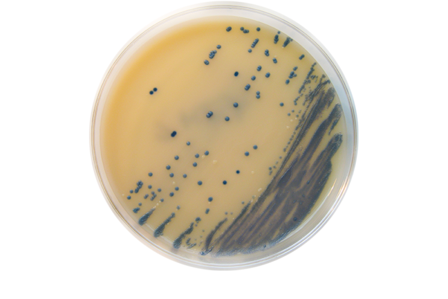 Methicillin-resistant Staphylococcus aureus (MRSA) on Brilliance MRSA Chromogenic Agar