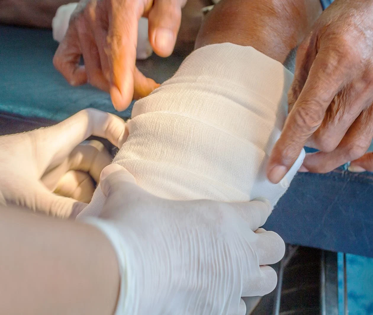 wound dressing being applied