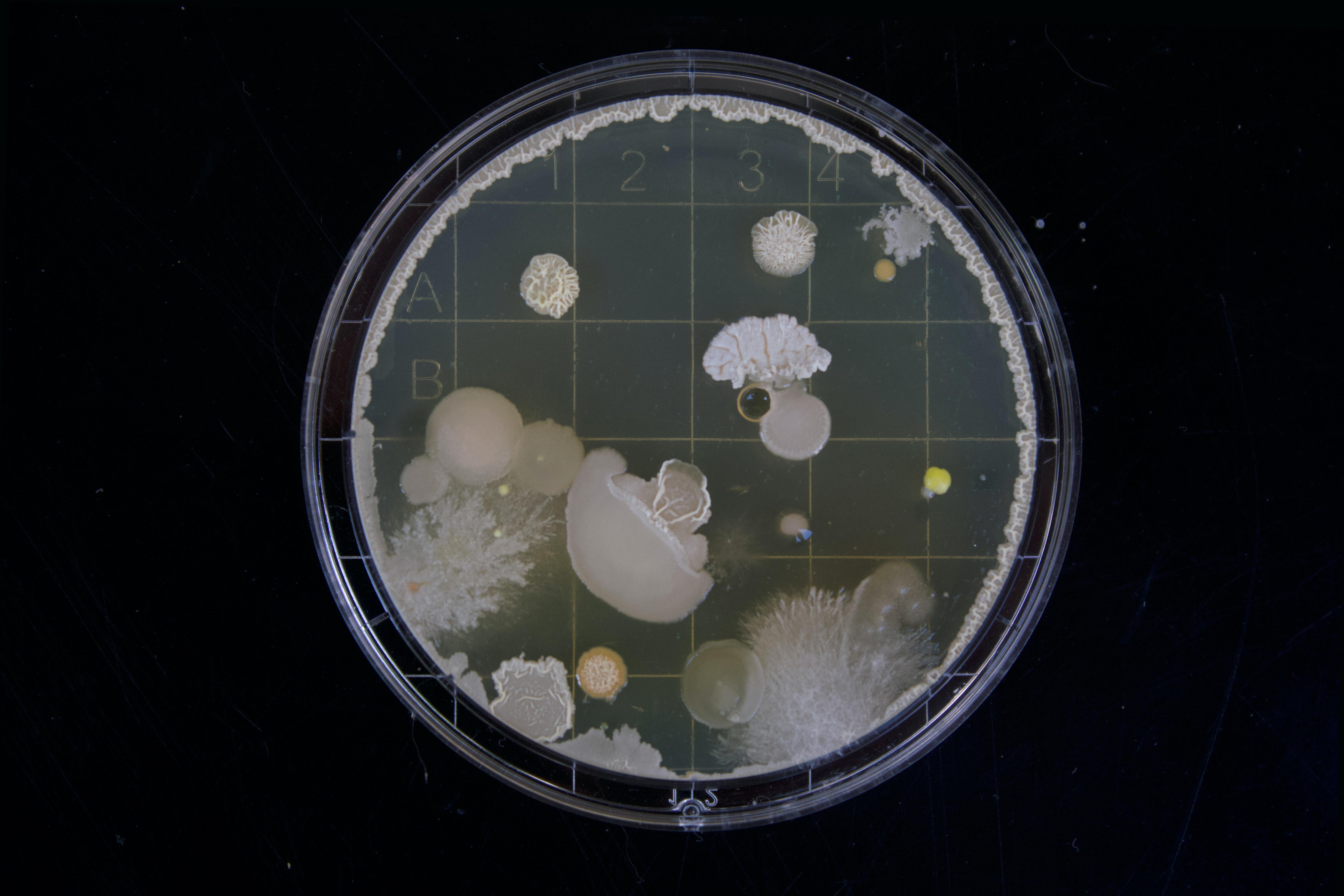 Gel plate of bacteria sample.