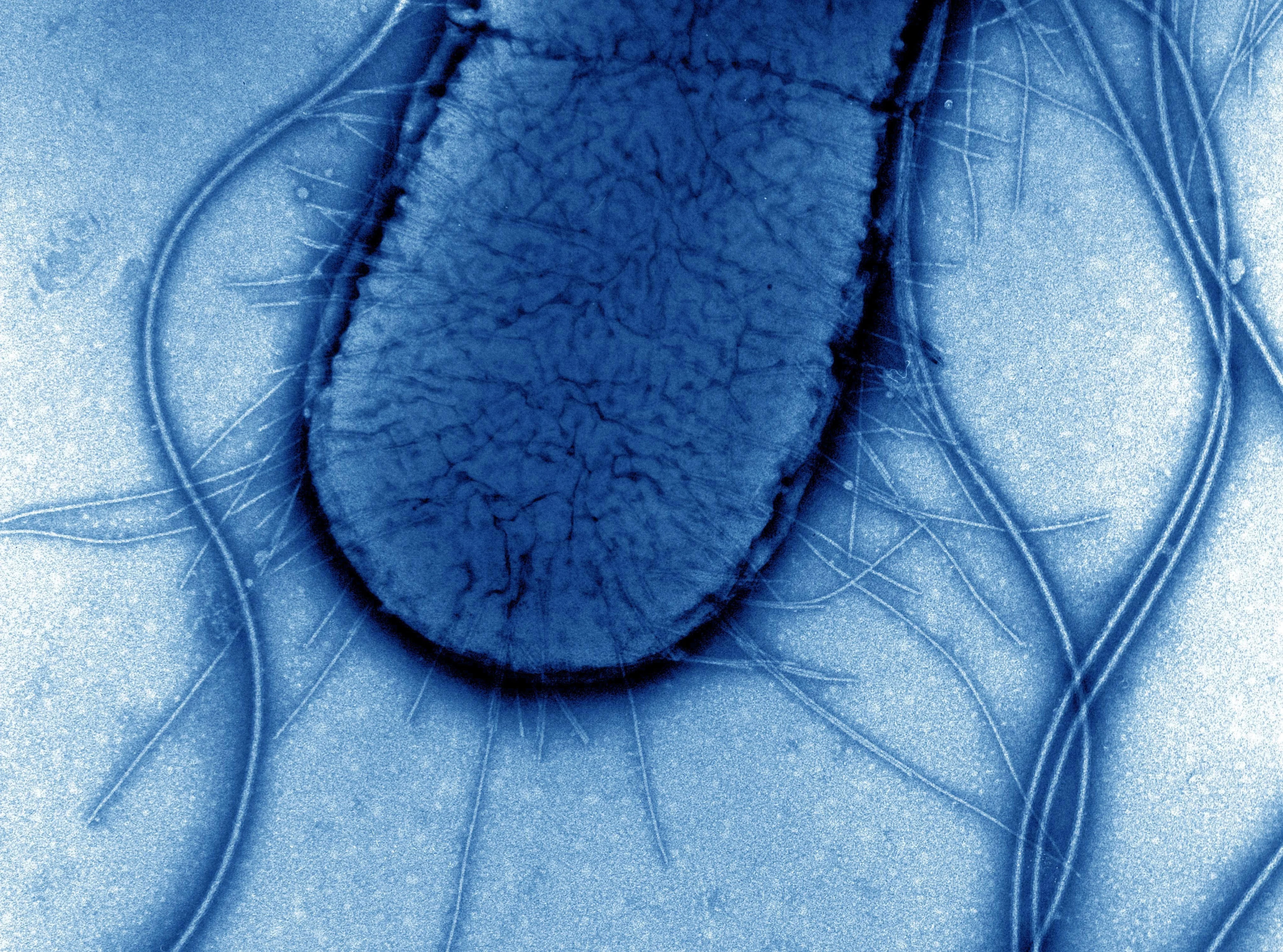 A transmission-electron microscopy image of an E. coli cell.